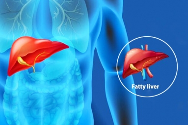 Body organs that can be affected by Fatty Liver Disease
