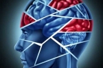 Brain stroke, Study, cooling treatment treats brain injuries and stroke says study, Head injury