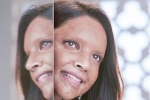 Chhapaak, Deepika Padukone new movie, first look of deepika padukone as acid attack survivor, Padmaavat