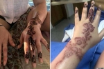 is brown henna safe, henna, henna tattoo cause aussie woman to almost lose her hand, Ppd