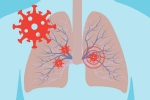 cytokine storm syndrome, Kawasaki disease, how does covid 19 affect different parts of the body, Spanish flu