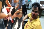 Madhav Chaudhary attack, Harsh Yadav and Madhav Chaudhary, social media demands justice for two noida students who are brutally attacked, Wme