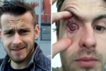 why can't you wear contact lenses in the shower?, can you wear contacts in the pool, contact lens wearers beware man goes blind after parasites eat man s eye as he wore lenses in shower, Eyesight