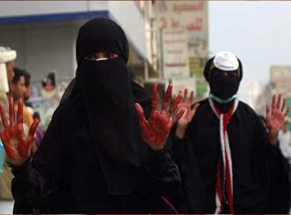 &#039;Dead woman&#039; comes alive in Yemen!